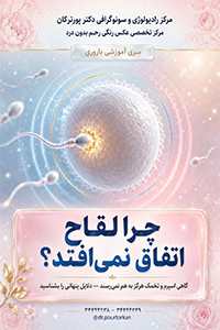 پست شش