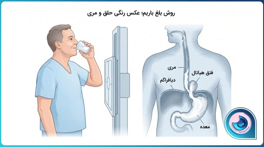 عکس رنگی حلق و مری با ماده باریم