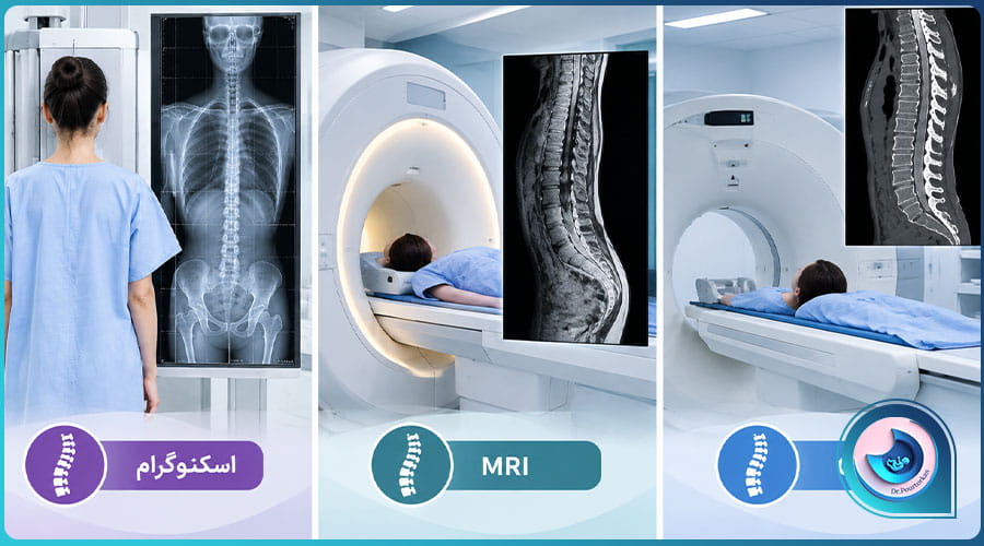 فرق اسکنوگرام ستون فقرات با MRI و CT